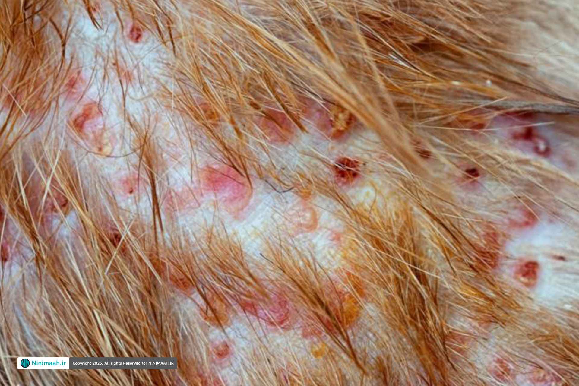 روش‌ های درمانی فولیکولیت موی سر