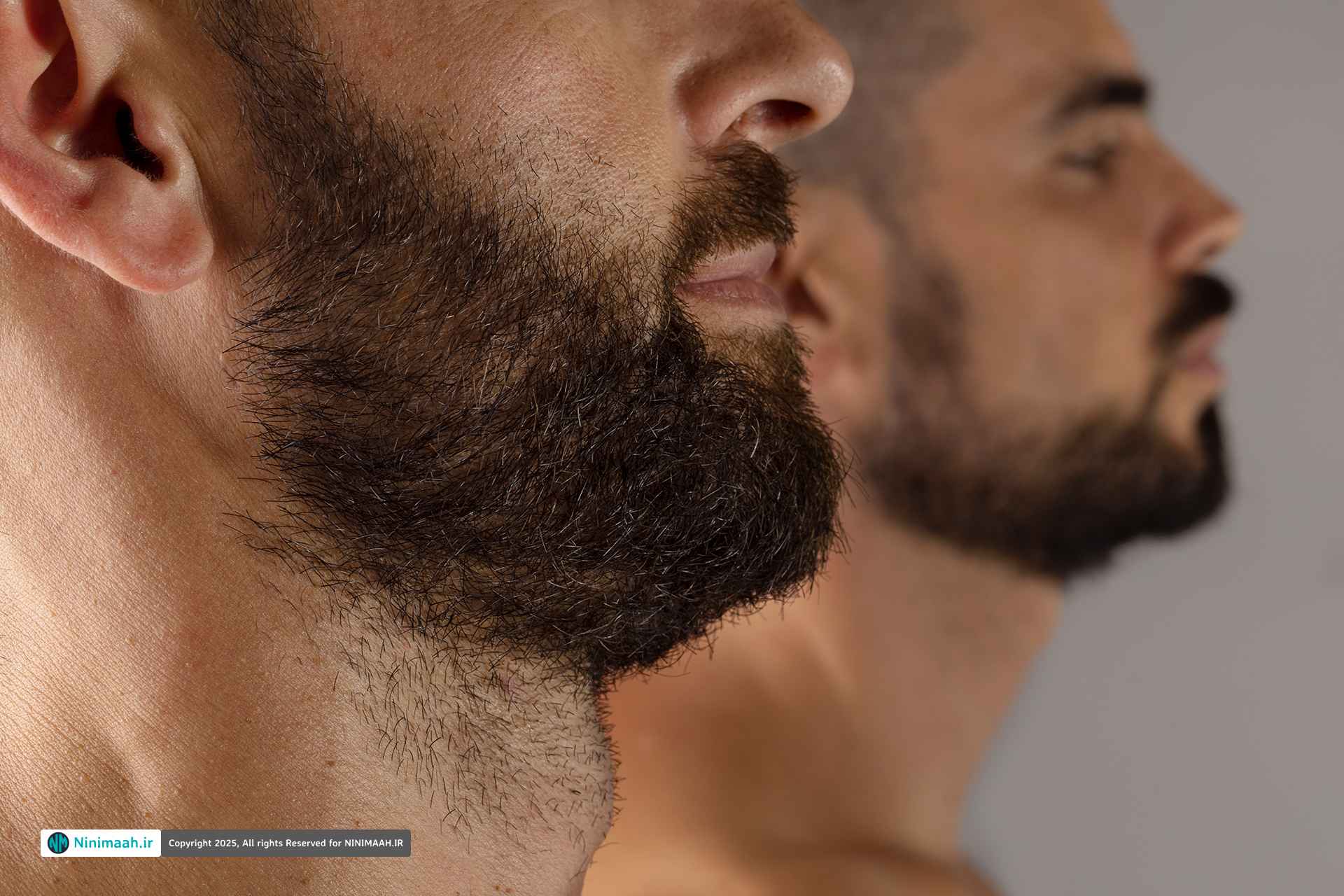 تأثیر کاشت ریش و سبیل بر زیبایی صورت