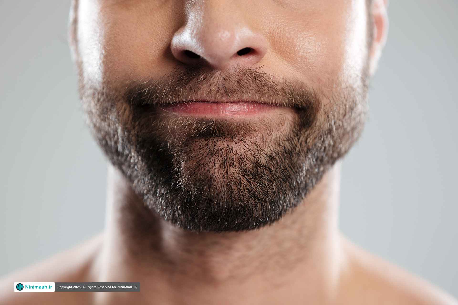 روش های متنوع کاشت ریش (کاشت ریش و سبیل)