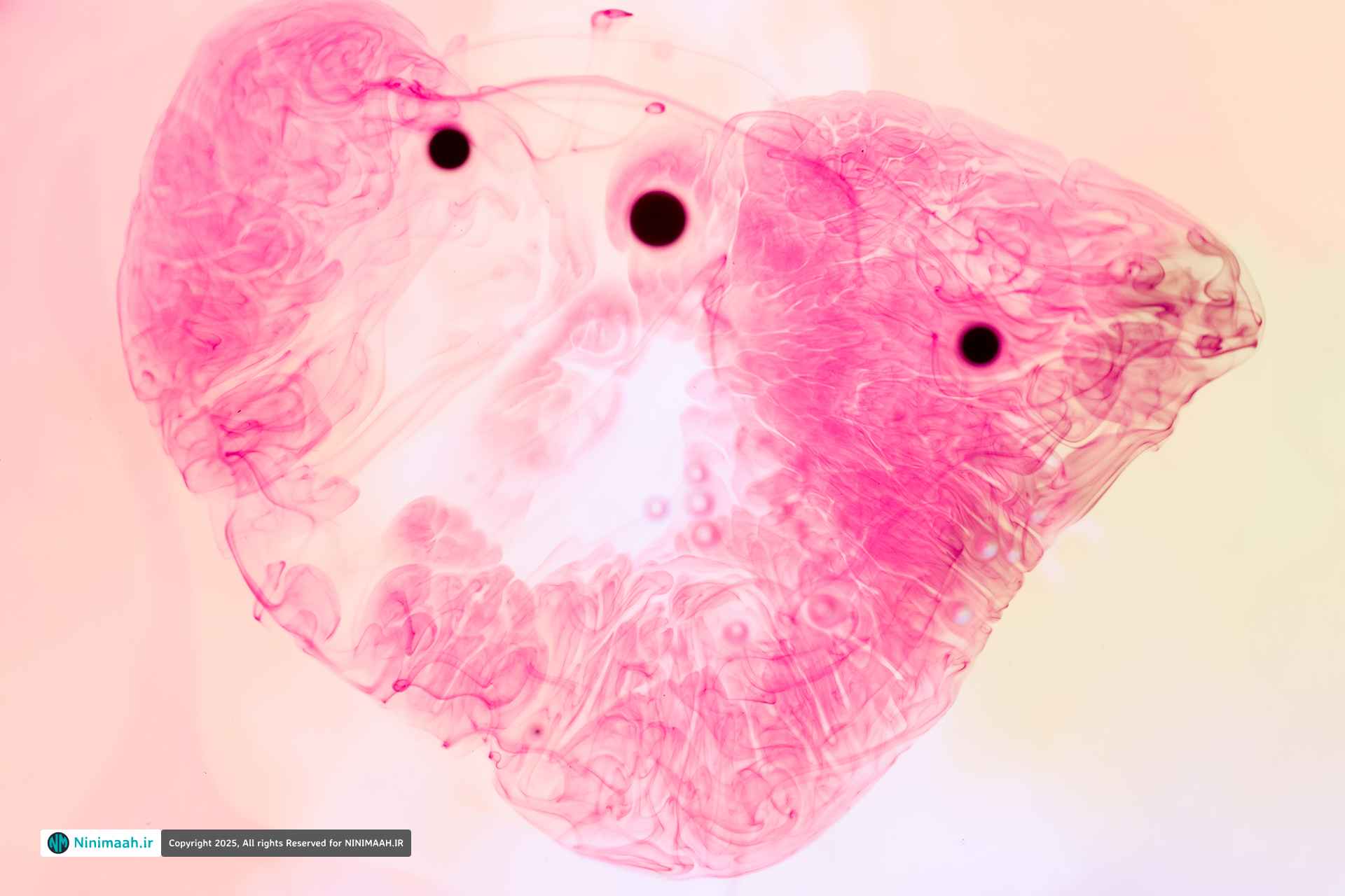 ایمن درمانی در سرطان سینه؛ تحول بزرگ در درمان بدون شیمی درمانی