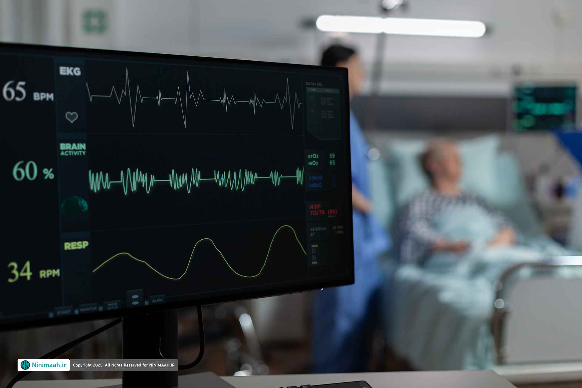 آنژیوگرافی قلب؛ همه چیز درباره روش تشخیص انسداد عروق قلبی